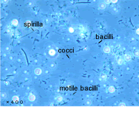 Intraoral microorganisms in a plaque taken from the interior of the mouth
